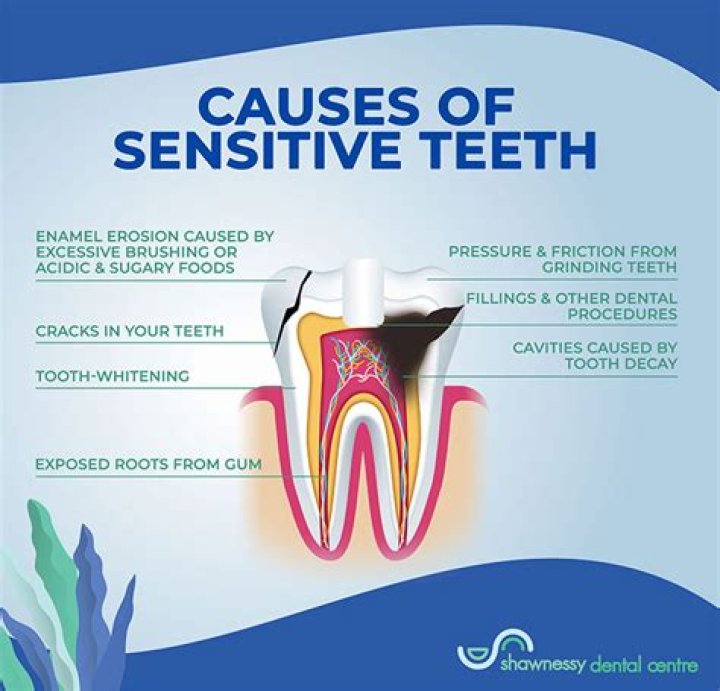 Why are all my teeth aching?
